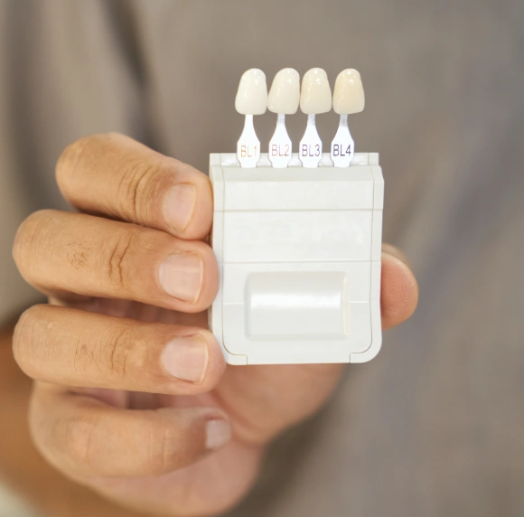 Hand holding a tooth shade guide with BL1 to BL4 whitening shade tabs